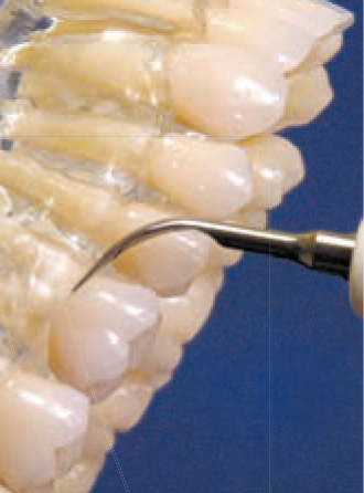 Acteon насадка №1 – Универсальная насадка для скайлинга