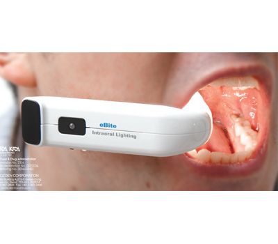 Dentozone eBite (Electronic Bite) - беспроводная система интраоральной подсветки и аспирации