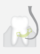 W&H P2LD — Изогнутая влево насадка с алмазным покрытием для обработки оголенных корней зуба