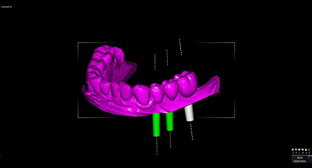 Owandy I-Max Touch 3D Ceph – Конусно-лучевой томограф 9х8