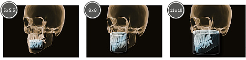 Sirona Orthophos SL 3D (11x10) – Дентальный томограф