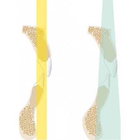 KaVo Pan eXam Plus 2D - датчик для панорамной рентгенодиагностики