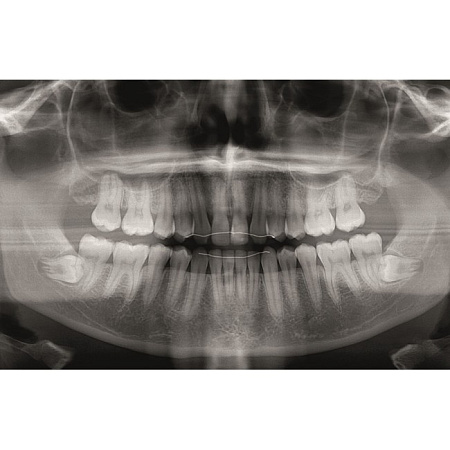 KaVo Pan eXam Plus 3D Ceph (2 датчика) - универсальный датчик Pan/Ceph для панорамной томографии, цефалостат, функция 3D-томографии 6x8 см