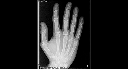 Owandy I-Max Touch 3D – Конусно-лучевой томограф 9х8