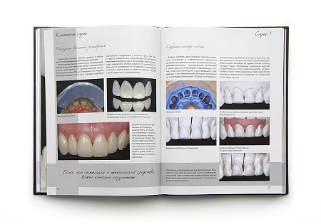 Эстетические стратегии в стоматологии. Искусство, наука и технологии. Стефано Инглезе