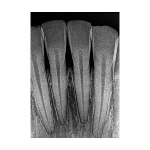 Carestream Kodak RVG 5200 - радиовизиограф